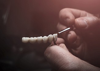 Lab technician making replacement teeth