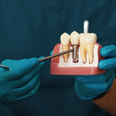 Dentist in teal scrubs and gloves pointing to sample dental implant