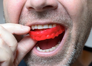 Man inserting red mouthguard over upper arch