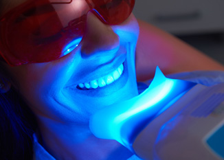 Closeup of woman with light expediting teeth whitening procedure