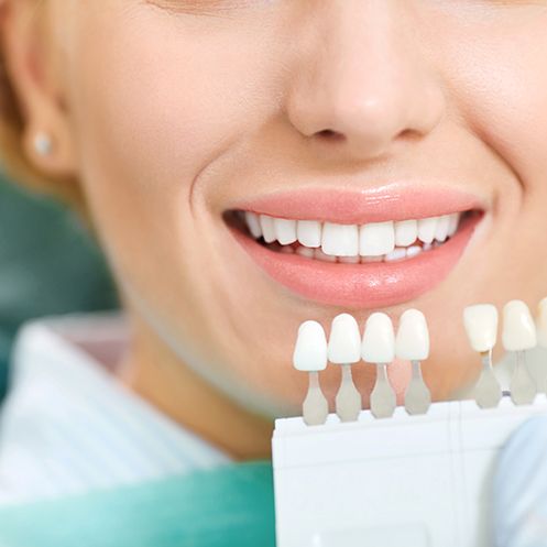 A dentist using a shade guide to assess a woman’s smile