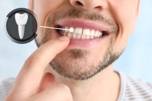 Nose to chin view of someone touching their teeth with a diagram indicating a dental implant